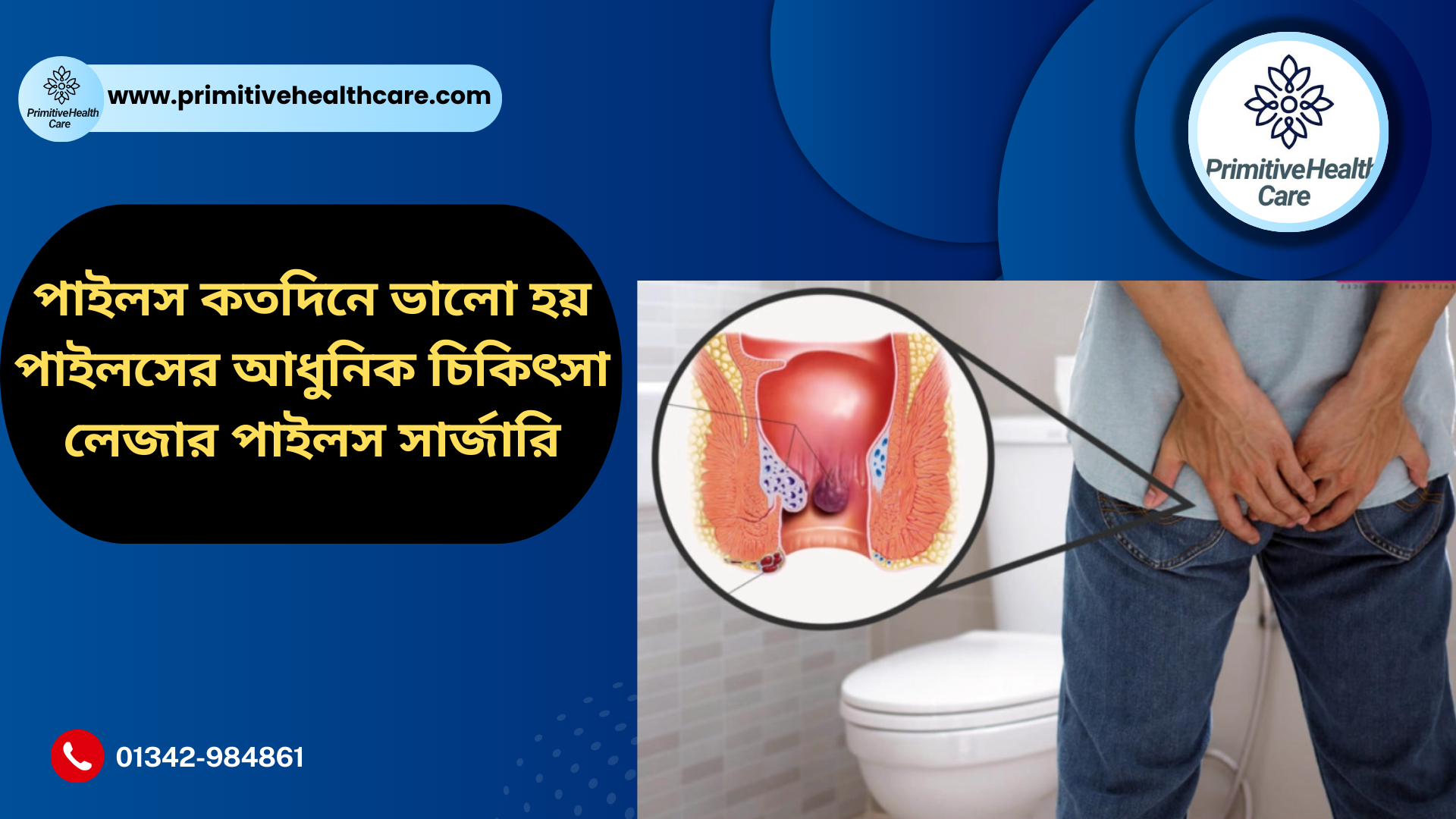 Piles Treatment with Medicine